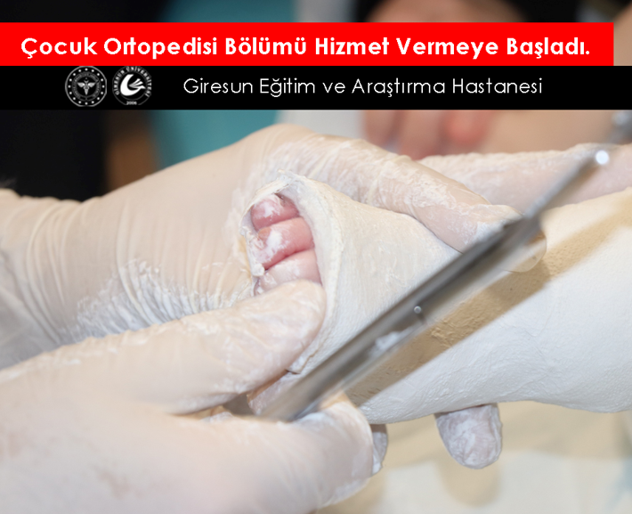 Eğitim ve Araştırma Hastanesi’nde Çocuk Ortopedisi Bölümü Hizmette