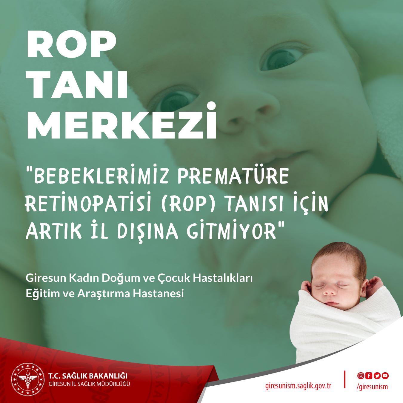 ROP Tanısı Artık Giresun’da da Yapılıyor